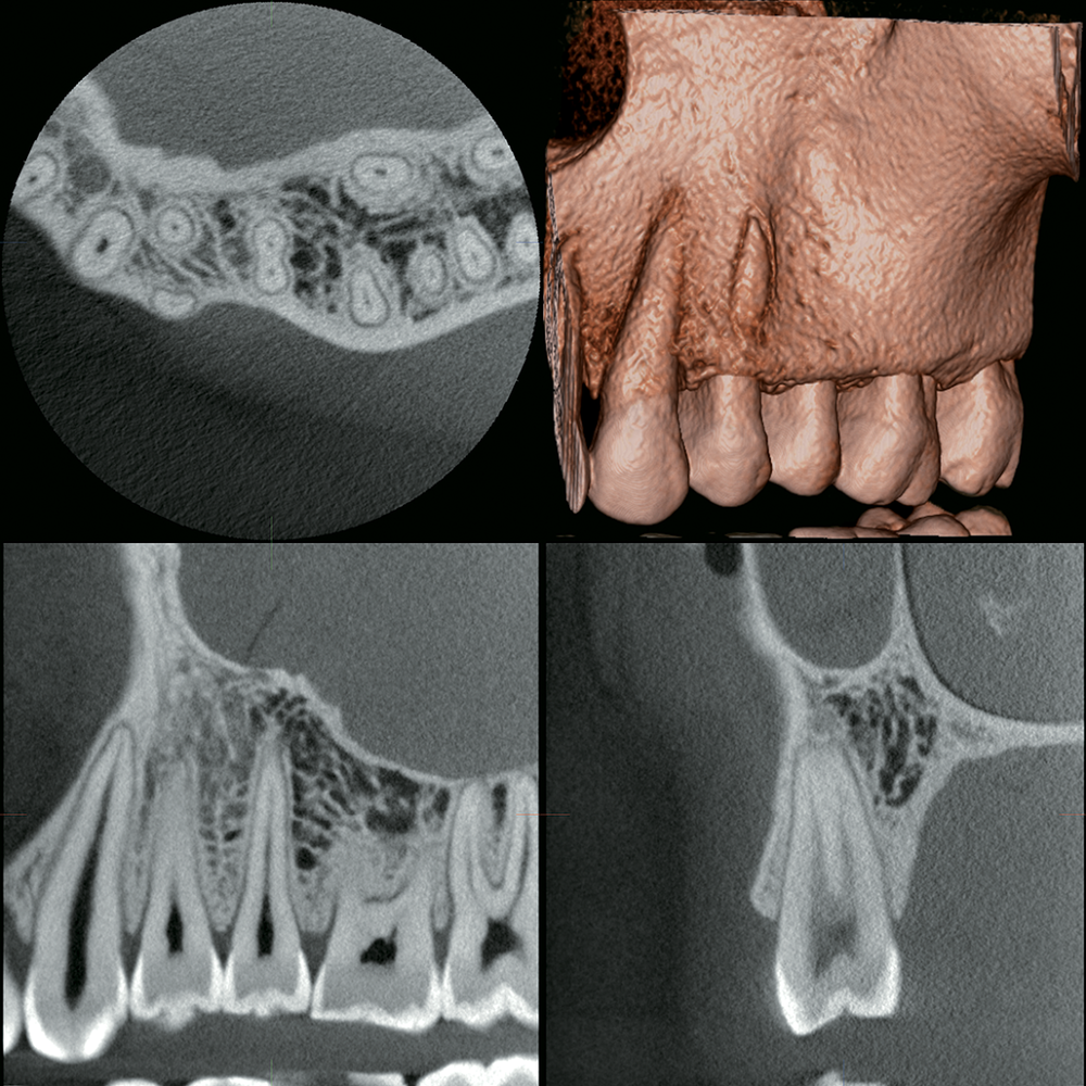 J. MORITA Veraview X800 2D/3D CBCT Unit | Henry Schein | Henry
